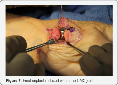 Click here to view Large Figure 7