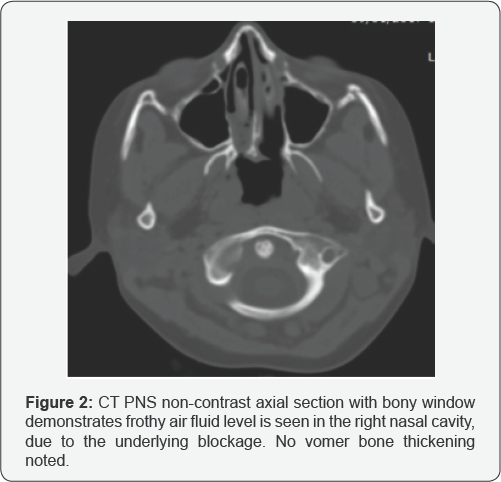 Click here to view Large Figure 2