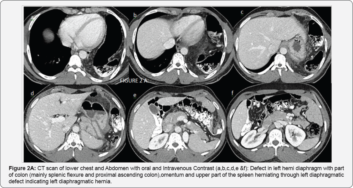 Click here to view Large Figure 2a