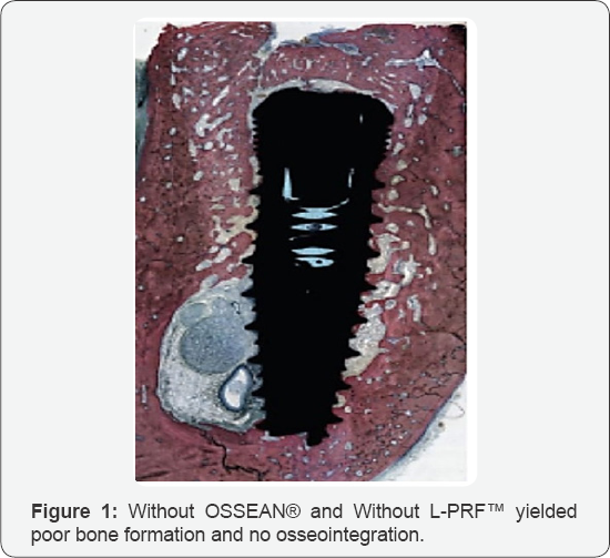 Click here to view Large Figure 1