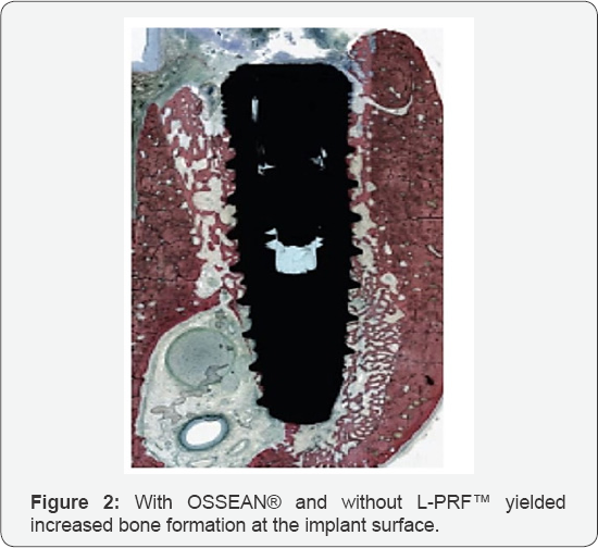 Click here to view Large Figure 2