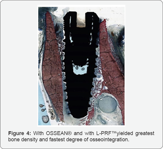 Click here to view Large Figure 4