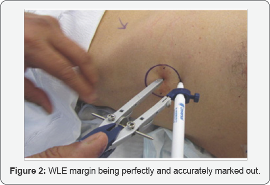 Click here to view Large Figure 2