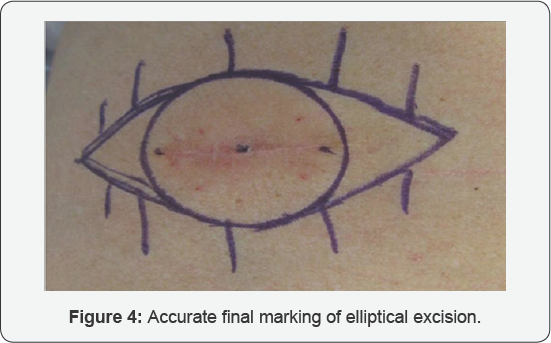 Click here to view Large Figure 4