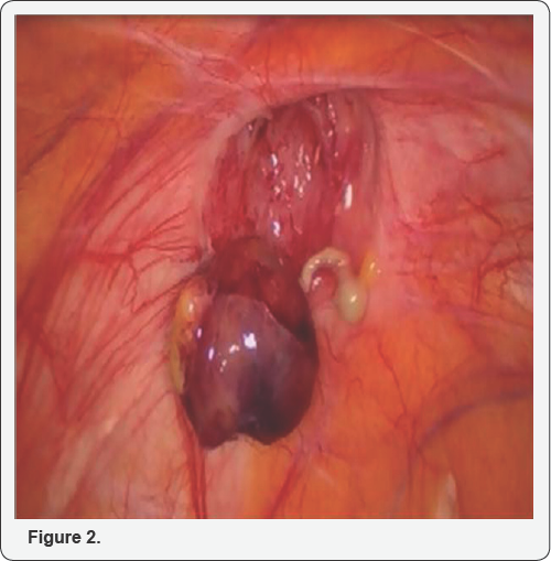 Click here to view Large Figure 2