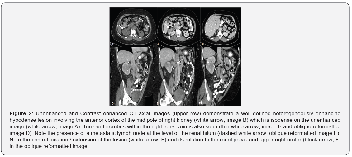 Click here to view Large Figure 2