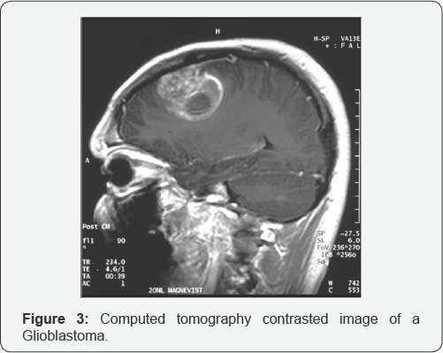 Click here to view Large Figure 3
