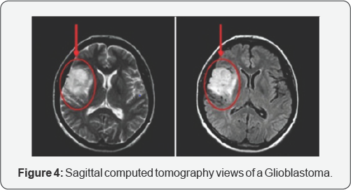 Click here to view Large Figure 4
