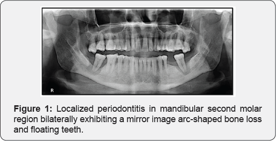 Click here to view Large Figure 1