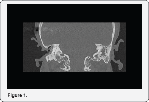 Click here to view Large Figure 1