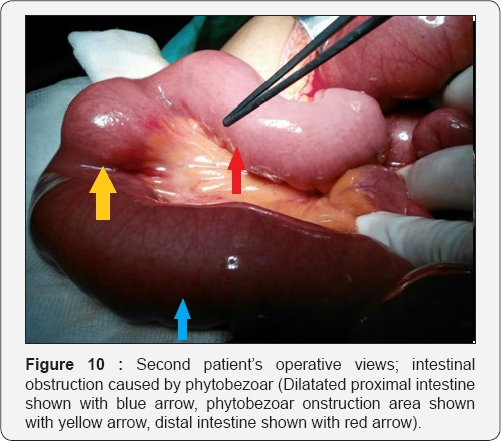 Click here to view Large Figure 10
