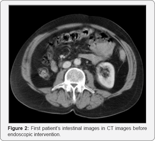 Click here to view Large Figure 2