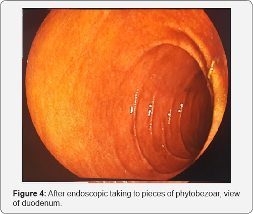 Click here to view Large Figure 4