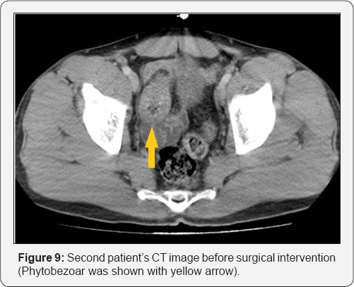Click here to view Large Figure 9