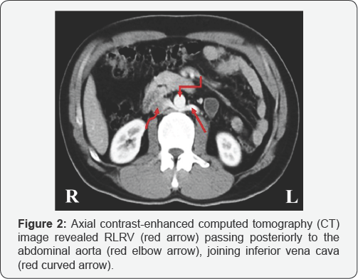 Click here to view Large Figure 2