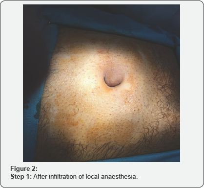 Click here to view Large Figure 2