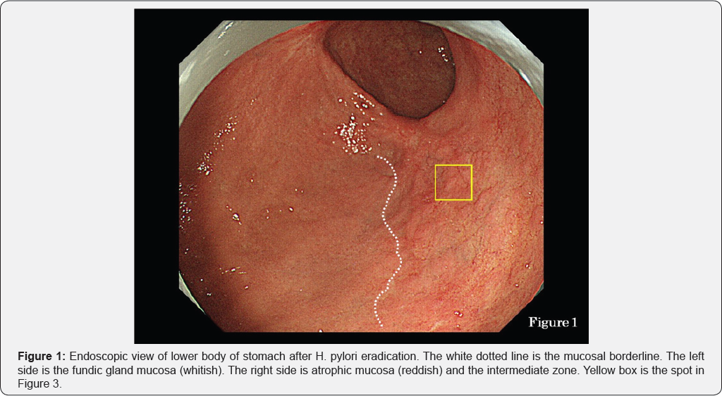 Click here to view Large Figure 1