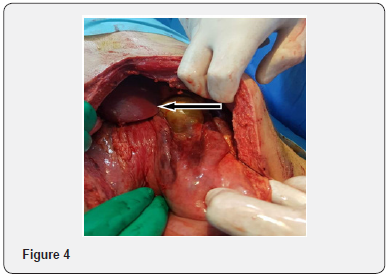 Click here to view Large Figure 4
