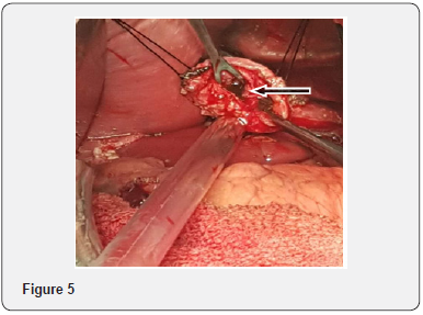 Click here to view Large Figure 5