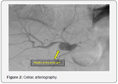 Click here to view Large Figure 2