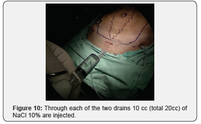 Click here to view Large Figure 10