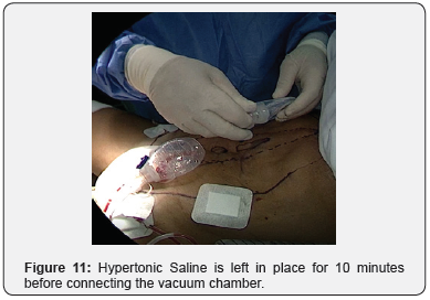 Click here to view Large Figure 11