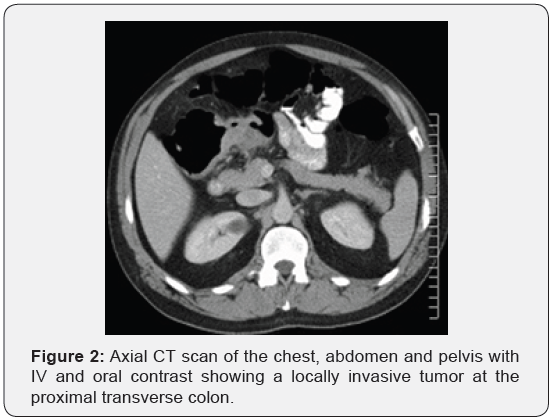 Click here to view Large Figure 2