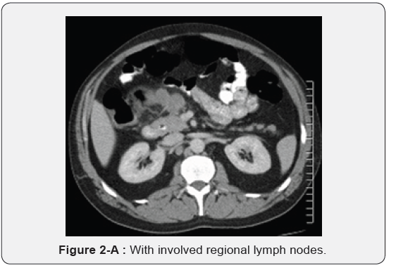 Click here to view Large Figure 2A