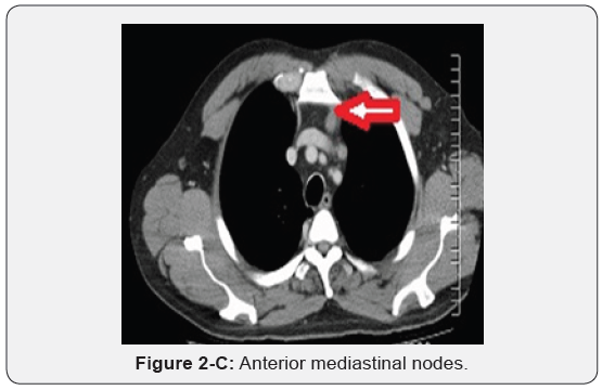Click here to view Large Figure 2C