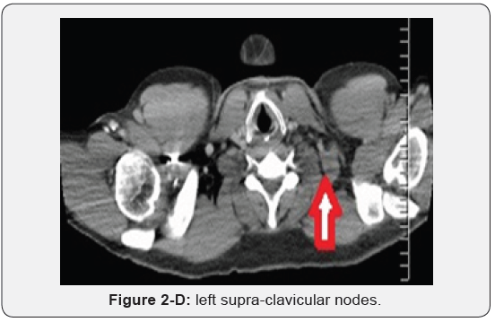 Click here to view Large Figure 2D