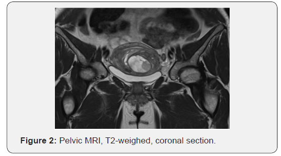 Click here to view Large Figure 2