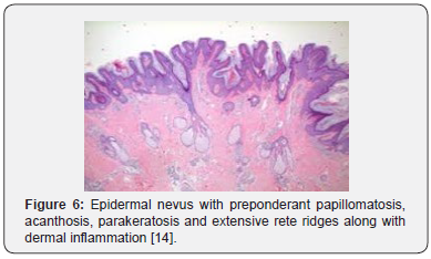 Click here to view Large Figure 6 Open Access Journal of Surgery