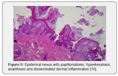 Click here to view Large Figure 9 Open Access Journal of Surgery