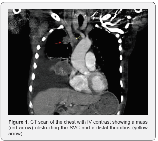 Click here to view Large Figure 1 Open Access Journal of Surgery