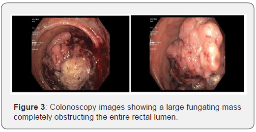 Click here to view Large Figure 3 Open Access Journal of Surgery