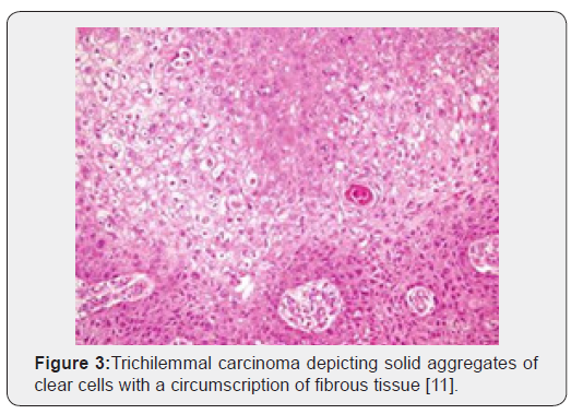 Click here to view Large Figure 3 Open Access Journal of Surgery