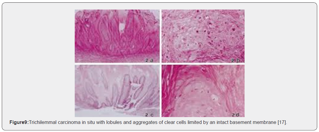 Click here to view Large Figure 9 Open Access Journal of Surgery