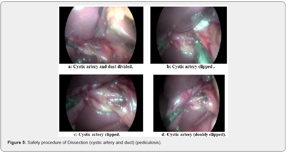 Click here to view Large Figure 5 Open Access Journal of Surgery