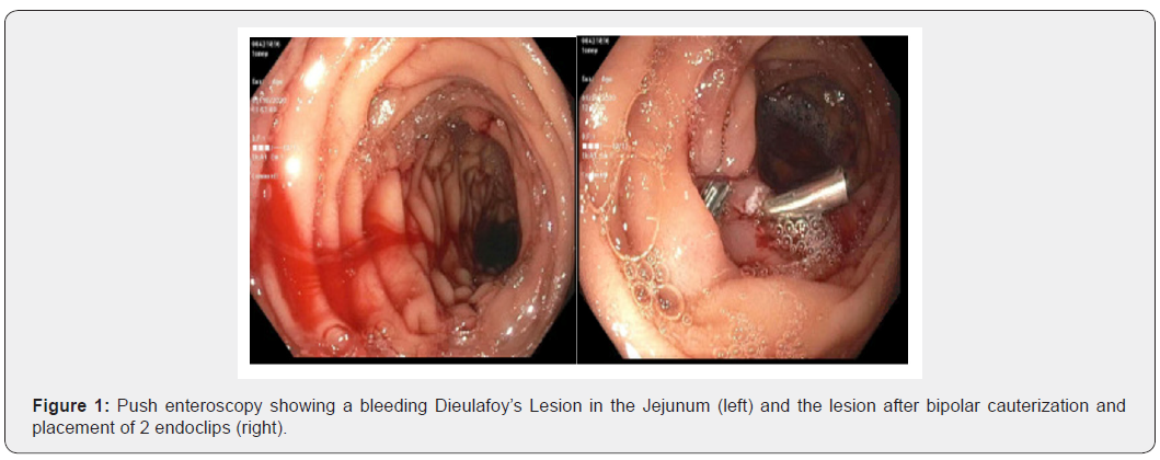 Click here to view Large Figure 1 Open Access Journal of Surgery