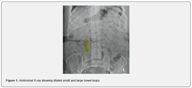 Click here to view Large Figure 1