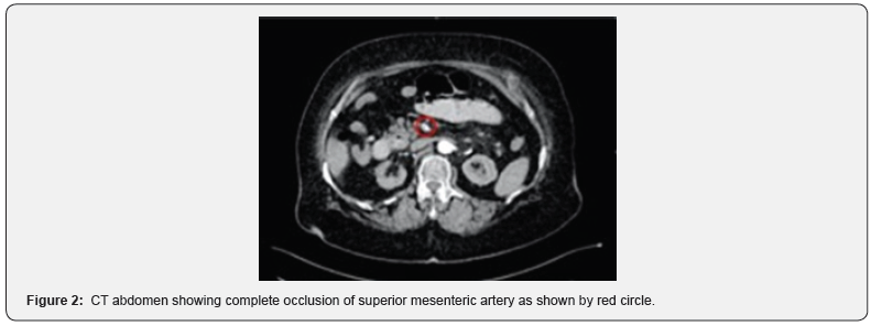 Click here to view Large Figure 2
