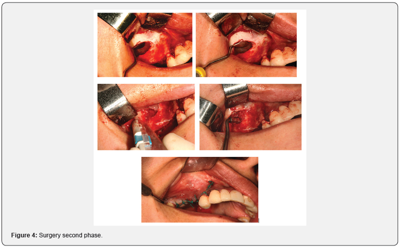 Click here to view Large Figure 4