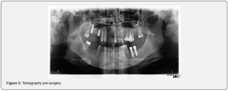 Click here to view Large Figure 5