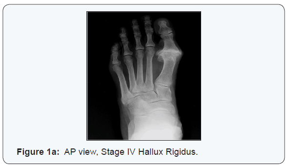 Click here to view Large Figure 1a