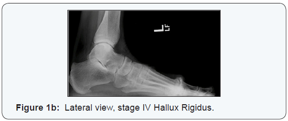 Click here to view Large Figure 1b