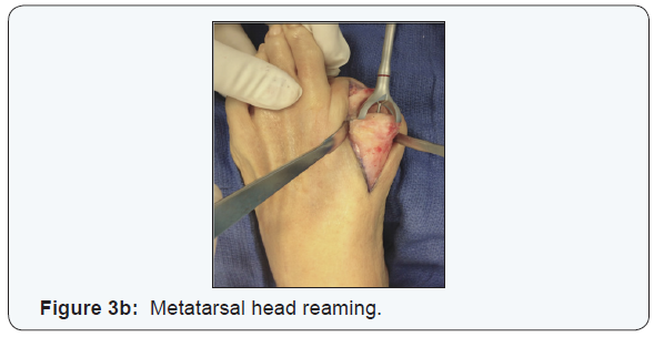 Click here to view Large Figure 3