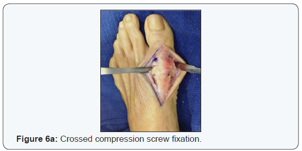 Click here to view Large Figure 4