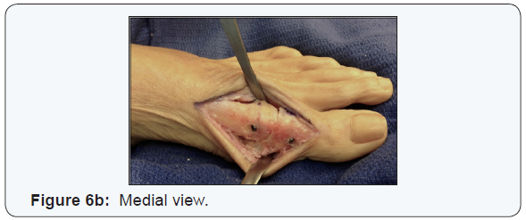 Click here to view Large Figure 4