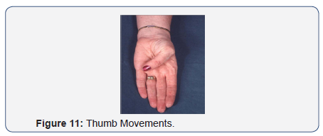 Click here to view Large Figure 11