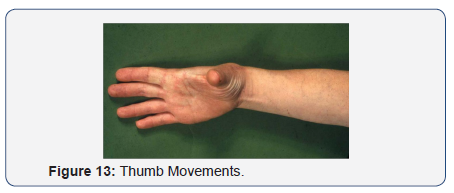 Click here to view Large Figure 13